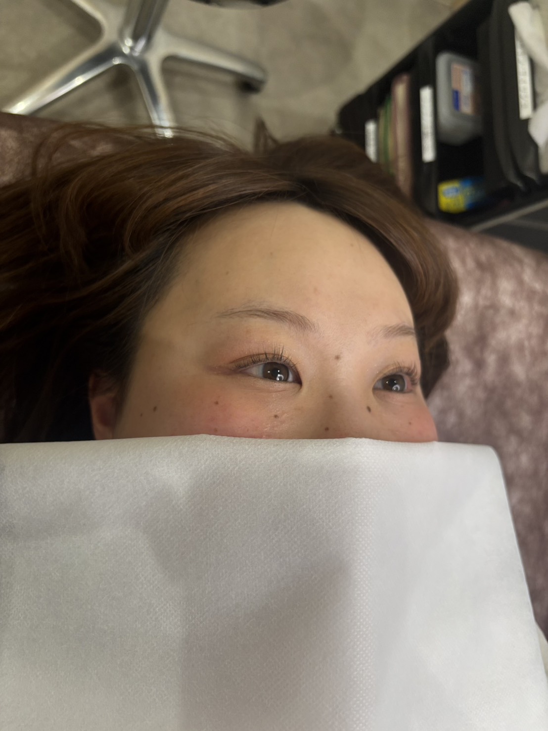 事例1 施術前