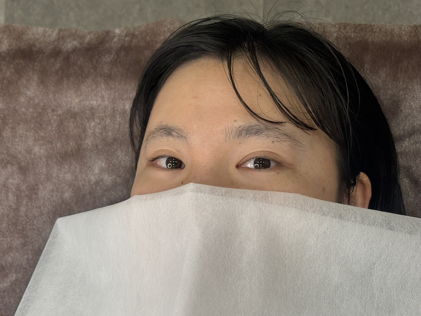 事例3 施術前